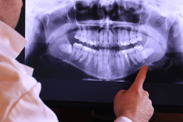 Best Urgent Care for Lost Fillings or Crowns in Piney Point Village, TX